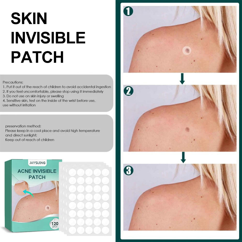 120pcs Invisible Acne and Pimple Patches